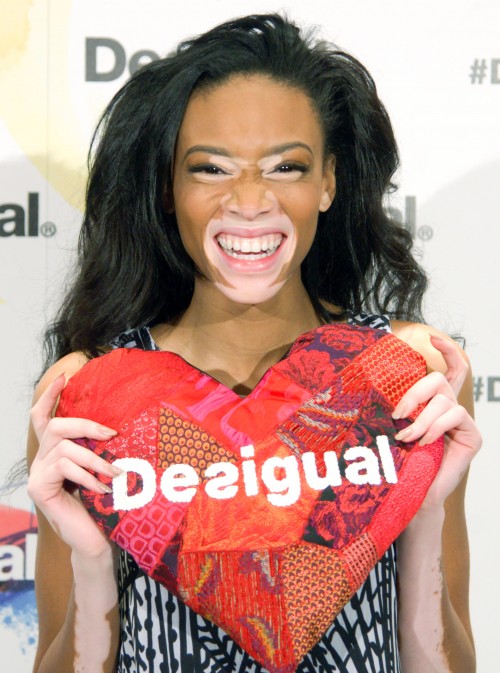 Winnie Harlow Presented as New Desigual Face for the Spring-Summer 2015 Campaign "Say Something Nice"