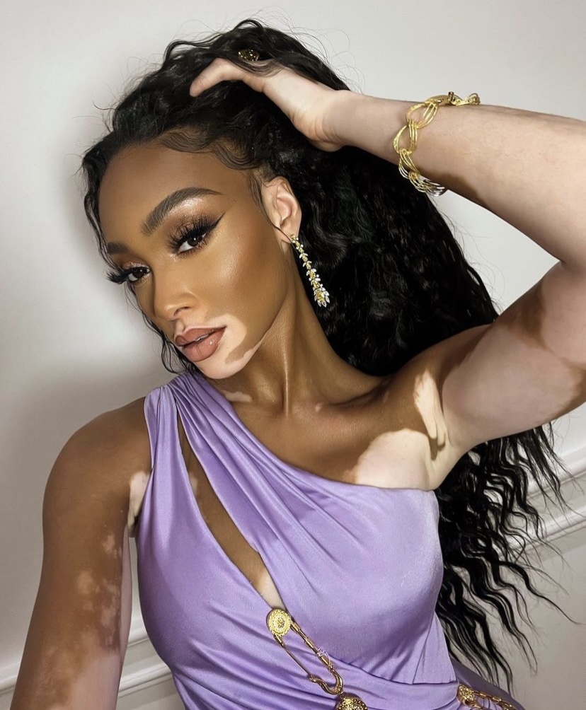 Model Winnie Harlow Shares 7 Days, 7 Looks With Vogue